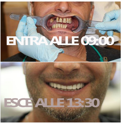 implantologia prezzi Milano